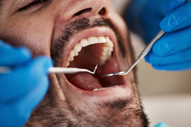 Best Dental Abscess Treatment in Elk Ridge, UT
